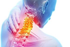Symptoms of cervical osteochondrosis and nutrition rules for disease