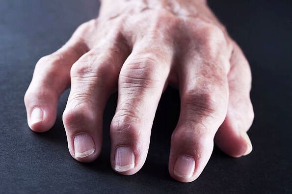pain in the finger joints